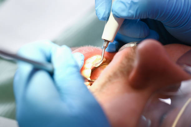Best Tooth Infection Emergency Dentist  in Hamilton, OH
